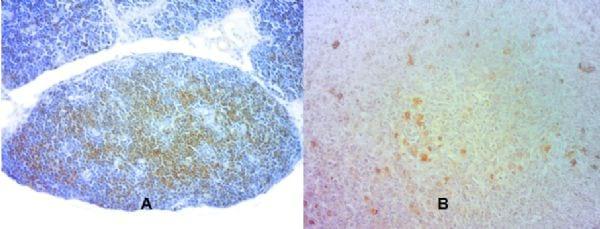 Efeito da janela de nascimento no incubatório sobre a presença de células cd3 positivas no sistema linfóide de frangos de corte oriundos de diferentes pesos de ovos de matrizes de mesma idade - Image 1