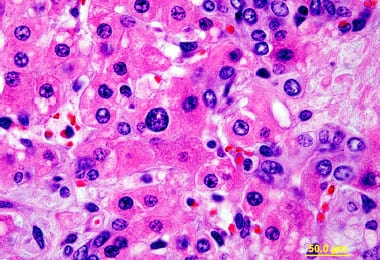 Intoxicação experimental por aflatoxina em bezerros - Image 14