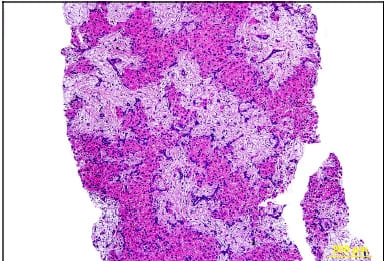 Intoxicação experimental por aflatoxina em bezerros - Image 7