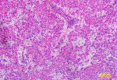 Intoxicação experimental por aflatoxina em bezerros - Image 11