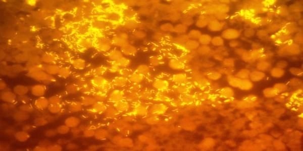 LOCALIZAÇÃO DE PASTEURELLA MULTOCIDA EM LESÕES PULMONARES DE SUÍNOS POR HIBRIDIZAÇÃO IN SITU FLUORESCENTE (FISH) - Image 1