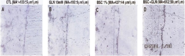 Impacto das úlceras gástricas - Image 4