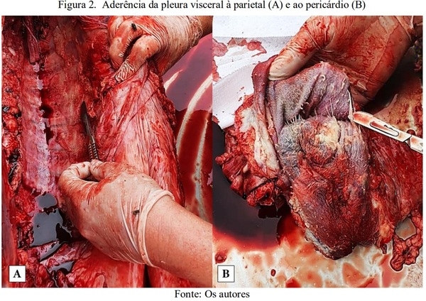 Pleuropneumonia fibrinosa em suino: relato de caso - Image 2