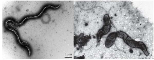 Escrita Brachyspira e Lawsonia: sintomas semelhantes, patógenos diferentes - Image 1