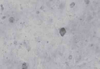 Linfadenite granulomatosa em suínos: linfonodos afetados e diagnóstico patológico da infecção causada por agentes do Complexo Mycobacterium avium - Image 9