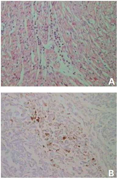 Causas infecciosas de problemas reprodutivos na produção de suínos - Image 2