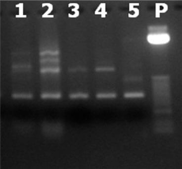 Desenvolvimento de Metodologia para Detecção Simultânea de Organismo Geneticamente Modificado e de Patógenos em Extrato Hidrossolúvel de Soja - Image 1