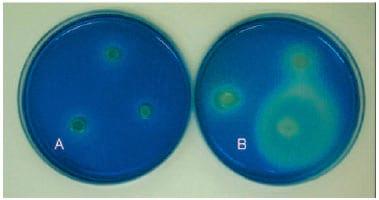 Avaliação do Método MSRV (Draft Annex D/ISO 6579:2002) para detecção de Salmonella spp em Farelo de Soja - Image 1