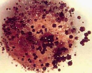Qualidade Sanitária de Grãos de Sorgo - Image 4