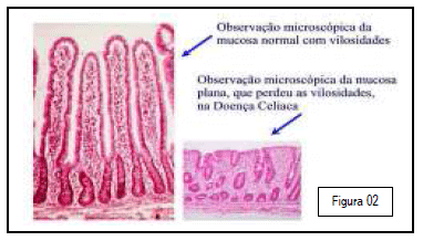 Integridade intestinal de frangos de corte quanto ao uso de novos aditivos nas dietas modernas - Image 9