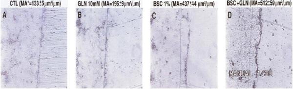 Impacto das úlceras gástricas - Image 4