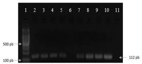 Figura 4: Gel de agarose (1,5%) da reação de PCR: (1) poço com marcador de peso molecular de 100 pb; (2) a (5) amostras líquidas da 1ª a 4ª coleta; (6) a (9) amostras sólidas da 1ª a 4ª coleta; (10) controle positivo; (11) controle negativo. Fonte: Elaborado pela autora (2022)