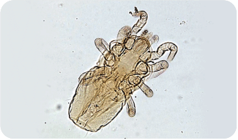 Figura 4. Imagem do ácaro Ornithonyssus spp.