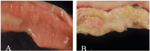 Figura 1. A: Duodeno infectado por E. acervulina em baixo grau, no qual a parede intestinal encontra-se espessada com presença de pontos esbranquiçados transversais. B: Duodeno infectado em grau máximo, em que se observa maior espessamento do intestino e coalescimento das lesões esbranquiçadas.