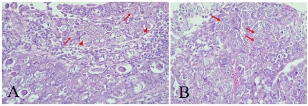 Figura 5. A: Macrogametas (setas) e microgametas (pontas de seta) em frango de corte, macho, 15 dias. B: Presença de esquizontes contendo merozoítos (setas) em frango de corte, macho, 15 dias.