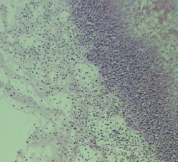 A Pasteurella Multocida Tipo A Atuaria Como Agente Primário nos Processos Pneumônicos dos Suínos? - Image 10