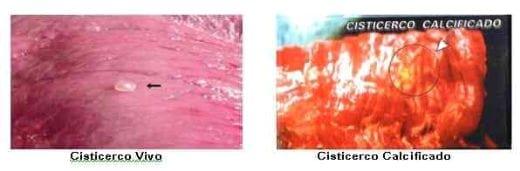 Cisticercose - Um assunto de saúde humana - Image 2