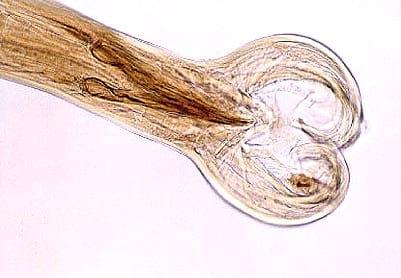 Epidemologia das verminoses - Image 3