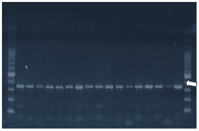 Pesquisa de genes de virulência em salmonella hadar em amostras provenientes de material avícola - Image 3