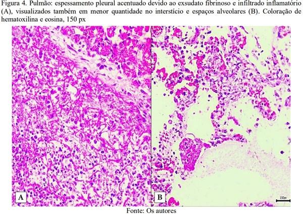 Pleuropneumonia fibrinosa em suino: relato de caso - Image 4