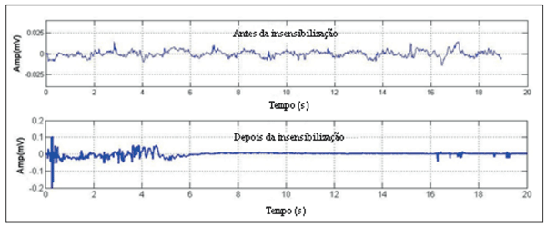 Figura 3. Padrão de EEG antes e depois da insensibilização