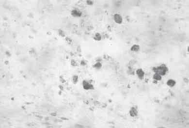 Linfadenite granulomatosa em suínos: linfonodos afetados e diagnóstico patológico da infecção causada por agentes do Complexo Mycobacterium avium - Image 10