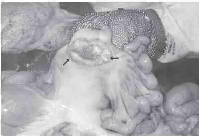 Linfadenite granulomatosa em suínos: linfonodos afetados e diagnóstico patológico da infecção causada por agentes do Complexo Mycobacterium avium - Image 3