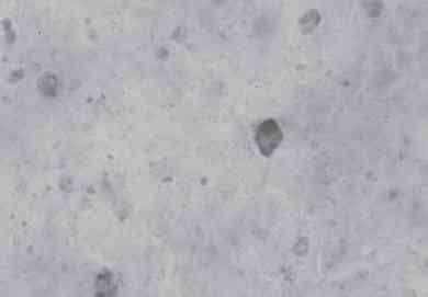 Linfadenite granulomatosa em suínos: linfonodos afetados e diagnóstico patológico da infecção causada por agentes do Complexo Mycobacterium avium - Image 9