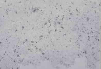 Linfadenite granulomatosa em suínos: linfonodos afetados e diagnóstico patológico da infecção causada por agentes do Complexo Mycobacterium avium - Image 11