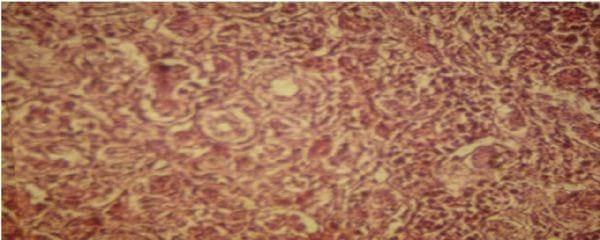 Diagnóstico de salpingite em fêmeas de frango de corte afetadas por micotoxicose - Image 2
